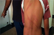 10-year-old beaten up allegedly by teachers at ludhianas Ryan International school